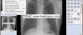 mahaon-pacs_1701257203